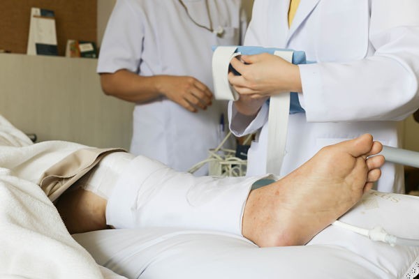 patient with broken leg in gurney