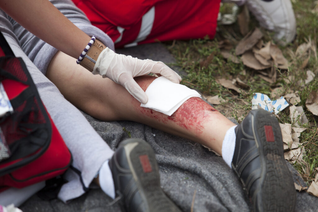 EMTs working on a man with a catastrophic injury