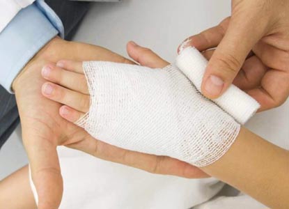 doctor bandages a burned wrist