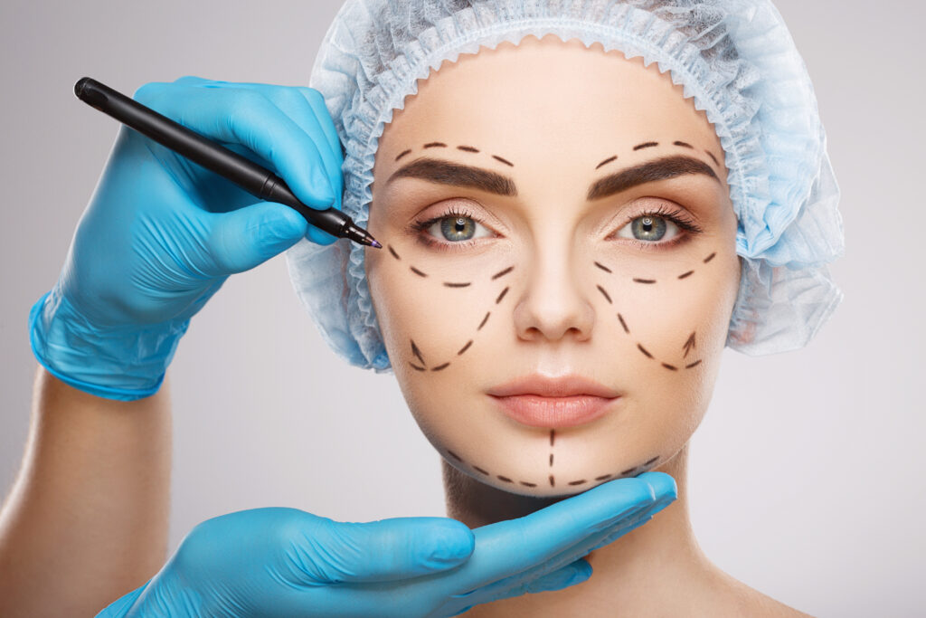 A women getting outlined for facial plastic surgery